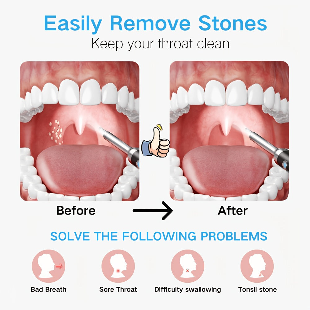 Trendbay Visual Tonsil Cleaner Kit