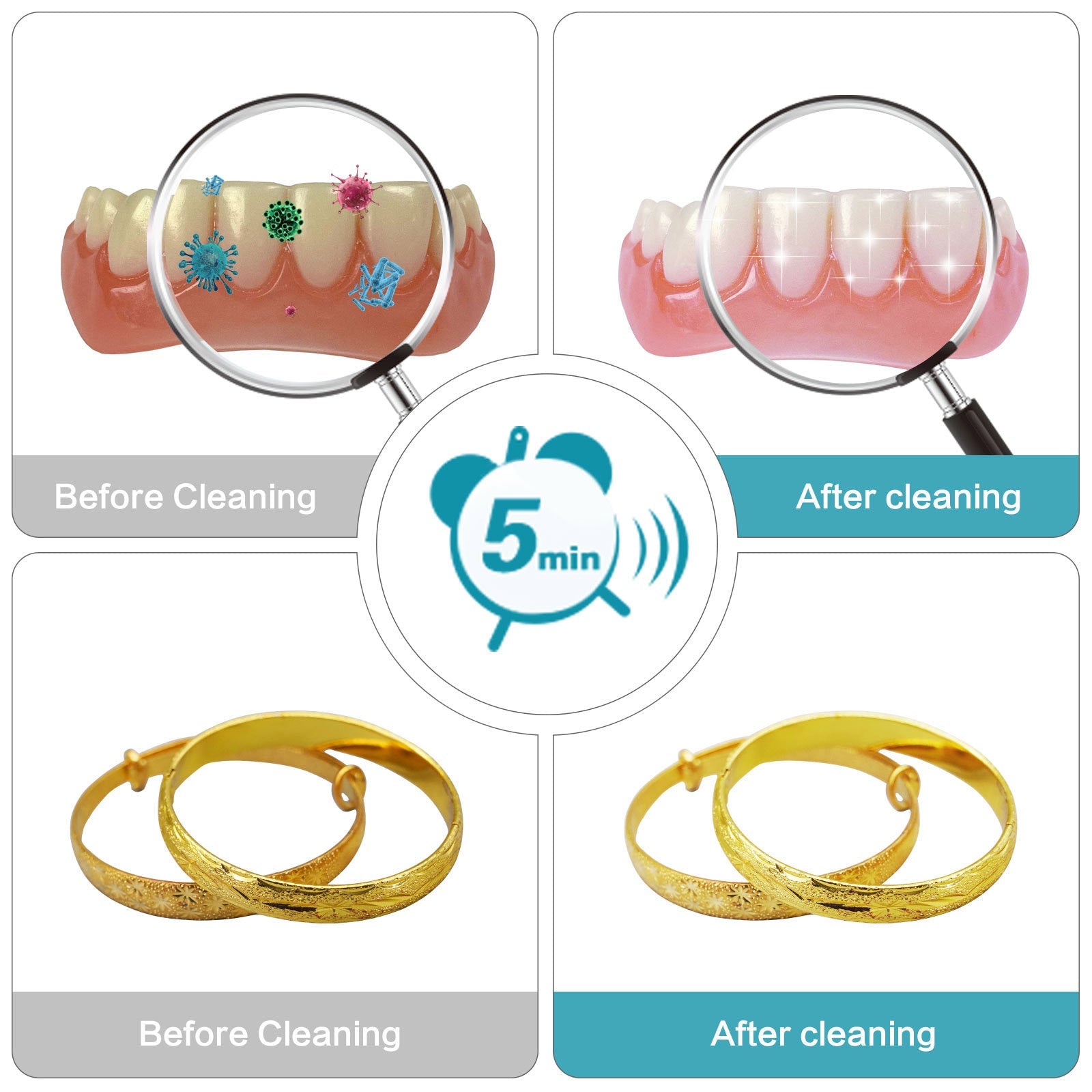 Trendbay Ultrasonic Cleaner Machine – 200ml Cleaning Device for Dentures, Aligners, Retainers, Jewelry & Watches