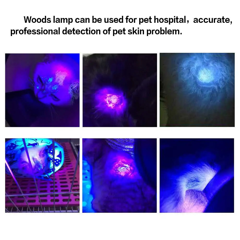 Trendbay Professional UV Skin Analyzer Wood Lamp for Facial Diagnosis