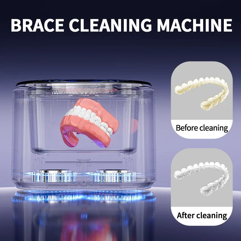 Trendbay Ultrasonic Cleaner – USB Electric Denture & Retainer Cleaning Machine