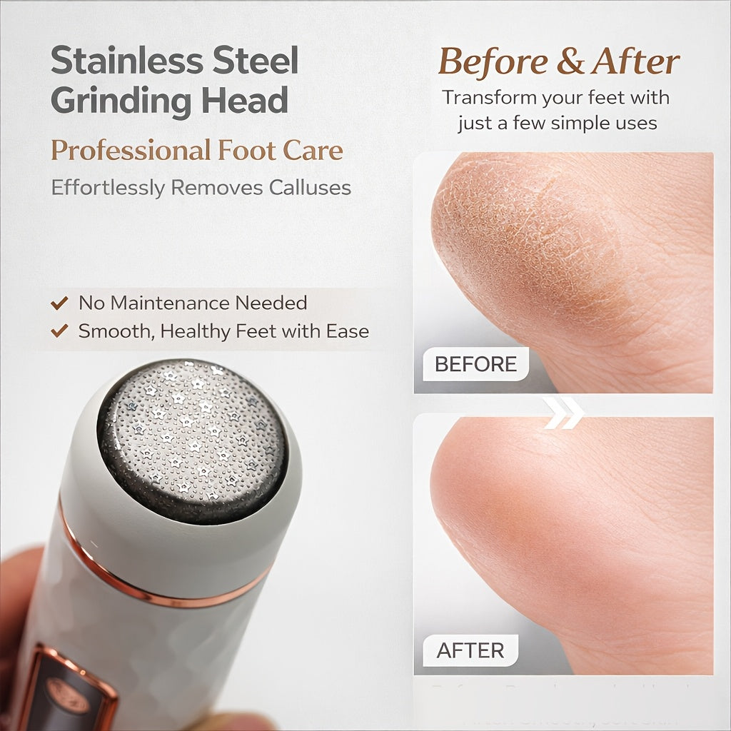 Trendbay Electric Callus Remover Foot File Kit
